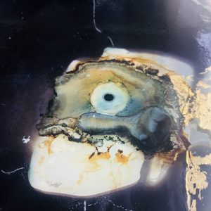 TENTACULITIS 2
